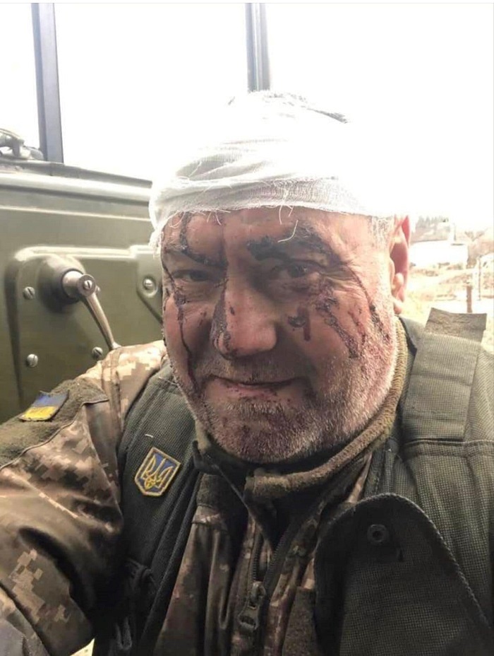 Костянтин Васюк після поранення (2022р.)